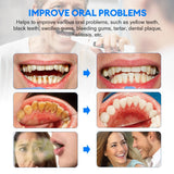 Load image into Gallery viewer, Electric Ultrasonic Dental Cleaner Teeth Whitening Calculus Removal Irrigator Teeth Plaque Stone Removal Tartar Eliminator
